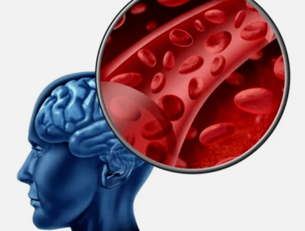 Osteochondral disease on the neck