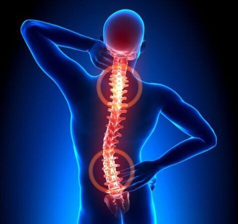 Osteochondral disease of the spine