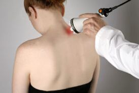 Treatment of cervical osteochondral disease with laser therapy