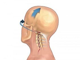 How does osteocartilage degeneration appear in the cervical vertebra