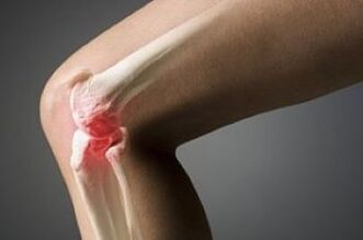 Knee articulation is a lesion of cartilage tissue