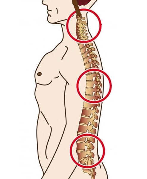 The spinal department where osteochondrosis occurs