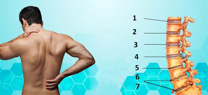 Stages of development of osteochondrosis